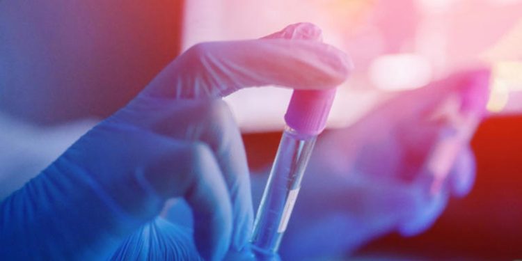 China crea un nuevo virus mutante altamente mortal con partes del virus del Ébola