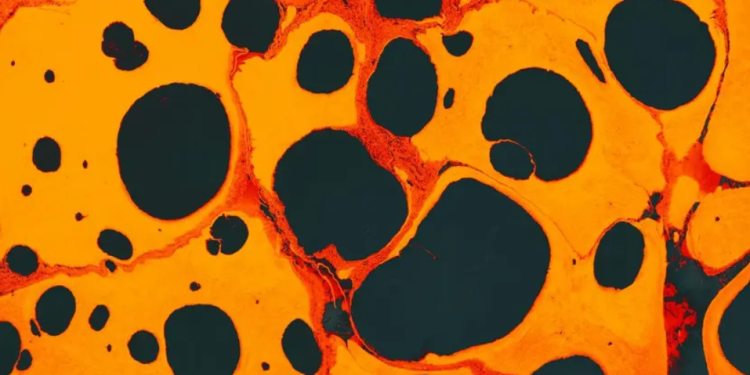 Científicos logran eliminar el VIH de células infectadas