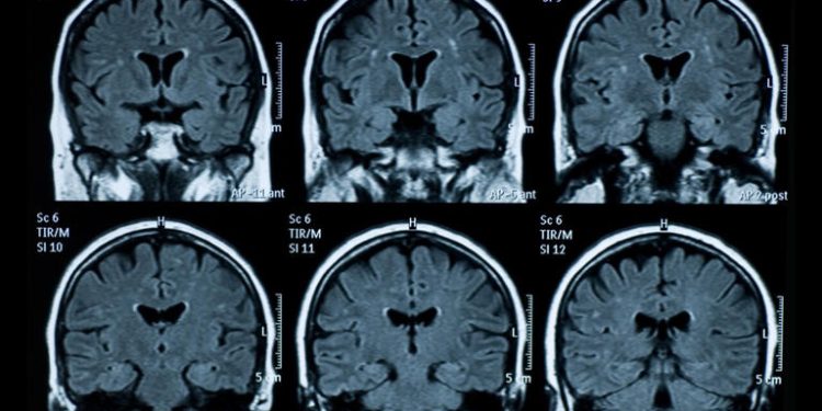Un superescáner muestra las primeras imágenes del cerebro humano