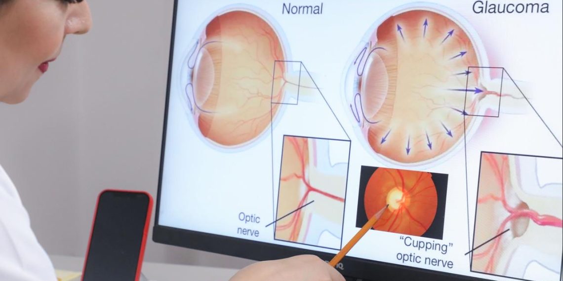 Exhorta IMSS a acudir al servicio de oftalmología para prevenir glaucoma