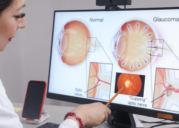 Exhorta IMSS a acudir al servicio de oftalmología para prevenir glaucoma 