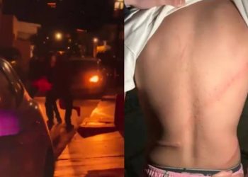 Policía Municipal de San Carlos agrede a un joven, le da una 'cintariza'
