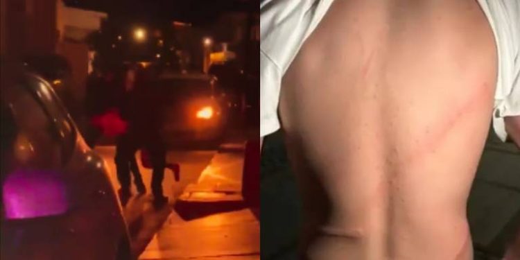 Policía Municipal de San Carlos agrede a un joven, le da una 'cintariza'