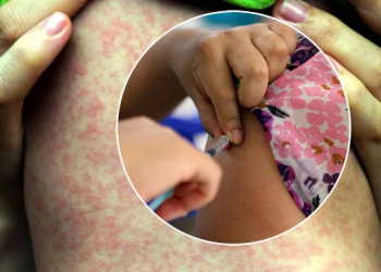 Inicia campaña nacional de vacunación a partir del 1ro de abril