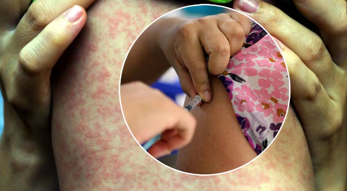 Inicia campaña nacional de vacunación a partir del 1ro de abril