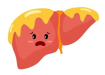 Hígado en riesgo: El precio del sedentarismo en niños.