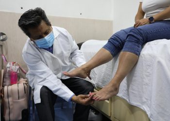 Alerta IMSS principales síntomas del síndrome Rubinstein-Taybi para recibir diagnóstico oportuno.