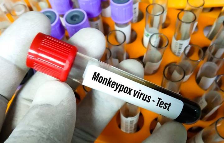 En Sonora no se han detectado casos de Viruela del Mono en migrantes.