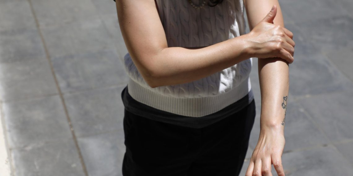 Llama IMSS a la población para prevenir cáncer de piel y evitar afectaciones en la calidad de vida.