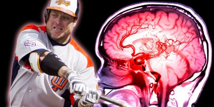 Karim García sufre una embolia.