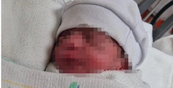 ISSSTE da la bienvenida al primer bebé del organismo en el 2026