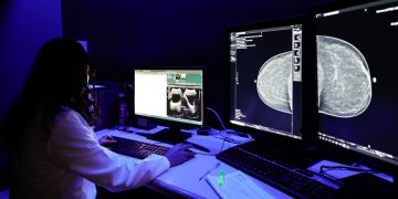 ISSSTE pone en marcha cuatro salas de interpretación de mastografías con Inteligencia Artificial: Martí Batres